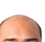 How To Stop Hair Loss For Men